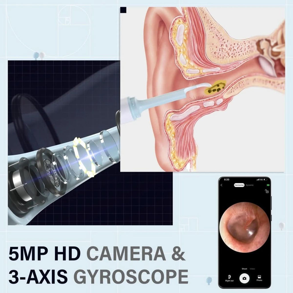 מנקה אוזניים HD ‏AURIVIEW — תצוגת מצלמה בזמן אמת, הנחיה חזותית קומפקטית