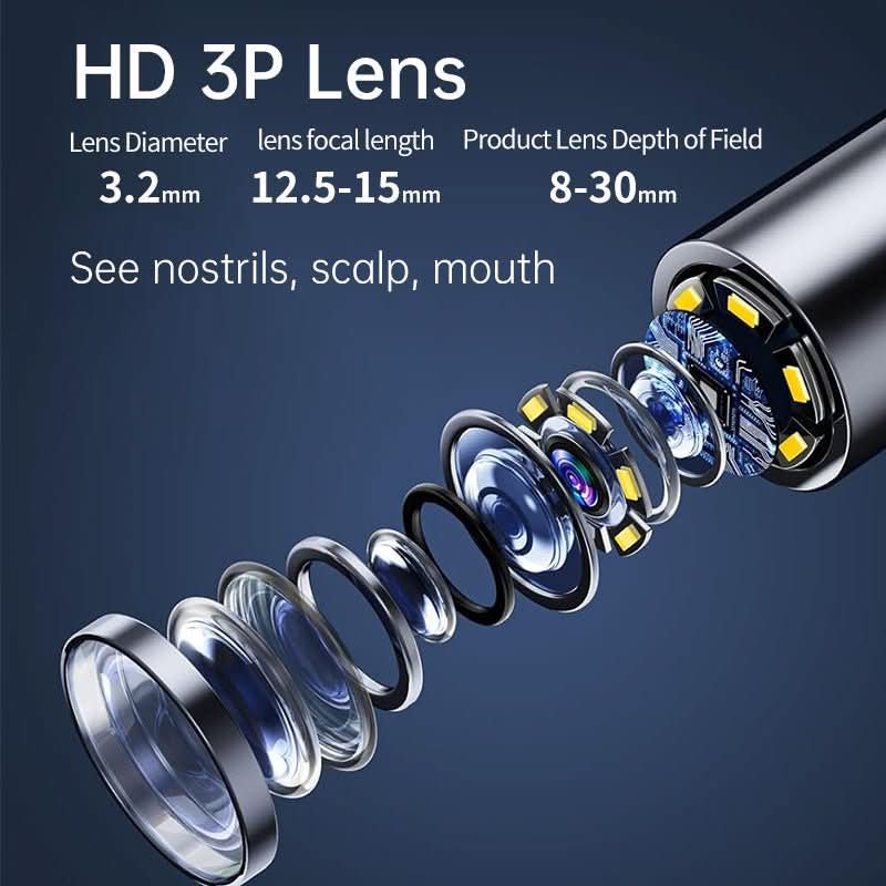 מנקה אוזניים HD ‏AURIVIEW — תצוגת מצלמה בזמן אמת, הנחיה חזותית קומפקטית