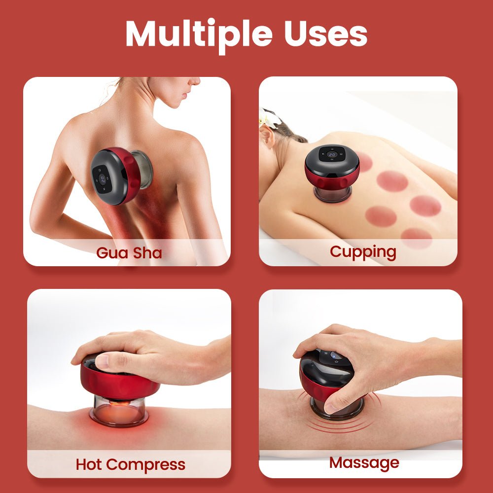 CuppingRelief Electric Cupping Set — Automated Suction Therapy Device