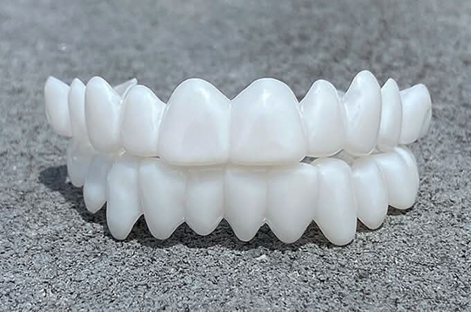 Facettes à l’aspect naturel FLEXIDENT — légères, ajustement réglable à la mâchoire