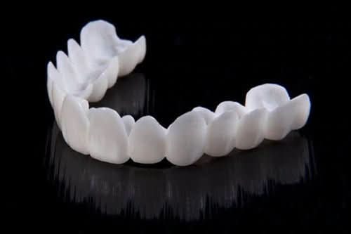 Facettes à l’aspect naturel FLEXIDENT — légères, ajustement réglable à la mâchoire