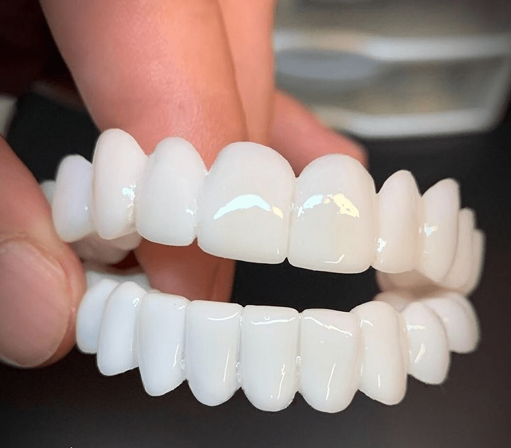 Facettes à l’aspect naturel FLEXIDENT — légères, ajustement réglable à la mâchoire