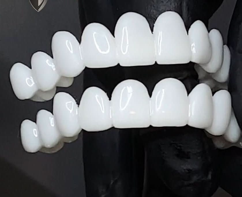 Facettes à l’aspect naturel FLEXIDENT — légères, ajustement réglable à la mâchoire